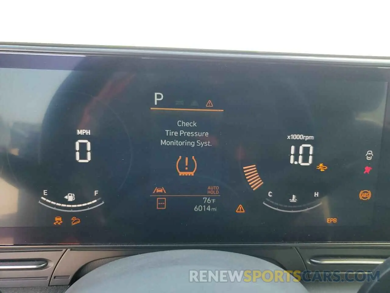 9 Фотография поврежденного автомобиля KM8HB3AB9RU101151 HYUNDAI KONA 2024